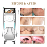 Skin Monarch Qantum Pro Diode & Picosecond Laser